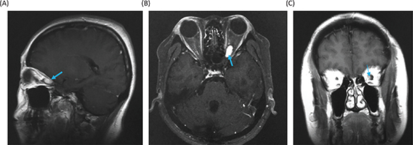 Fig 5